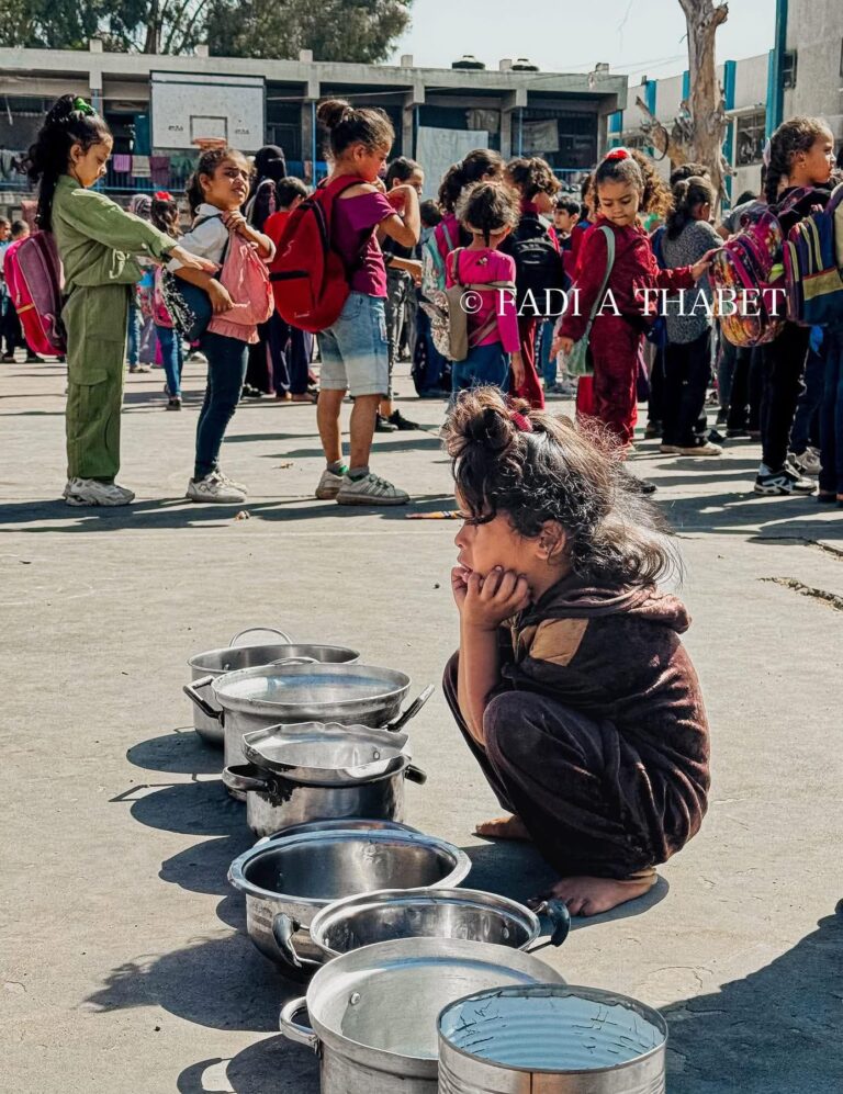 أطفال غزة.. ألم وحكاية