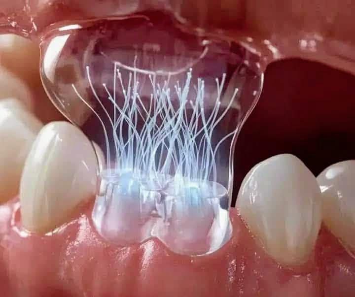 سبق علمي مثير : كوريا الجنوبية تبتكر لاصقة قد تغني عن أطقم الأسنان وزراعتها إلى الأبد.