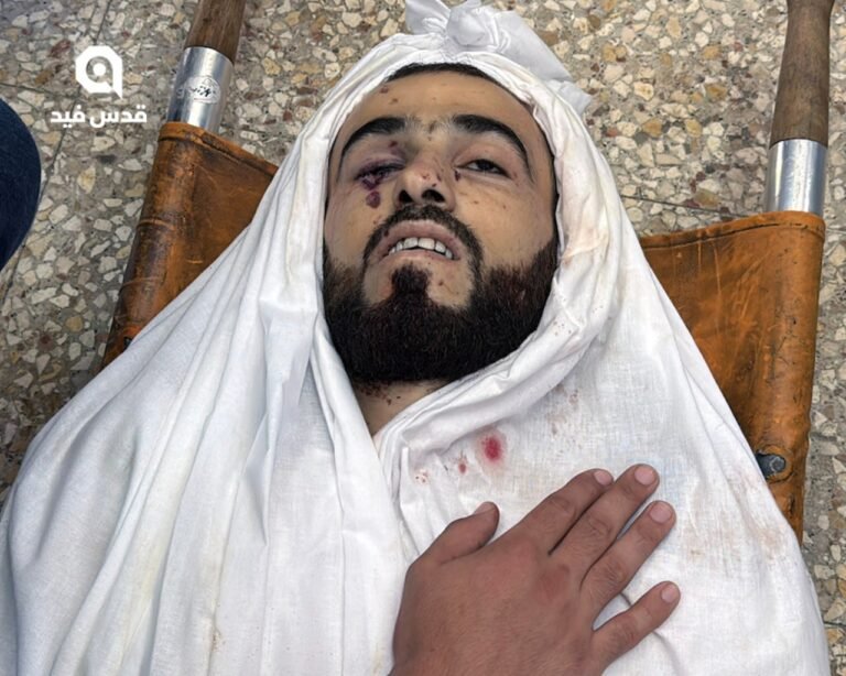 ارتفاع حصيلة شهداء غزة إلى 73,422 منذ بدء العدوان